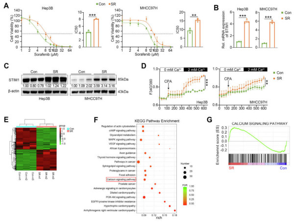  STIM1: the cancer shield against sorafenib unmasked 