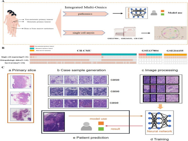 AI-Driven Advancements in Neuroblastoma Diagnosis and Bone/Bone Marrow Metastasis Prediction