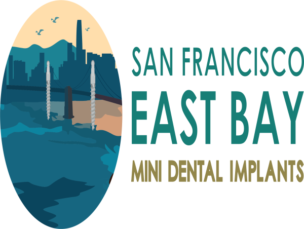  Dr. Rose Magno Unveils New Innovative Website for San Francisco East Bay Mini Dental Implants 