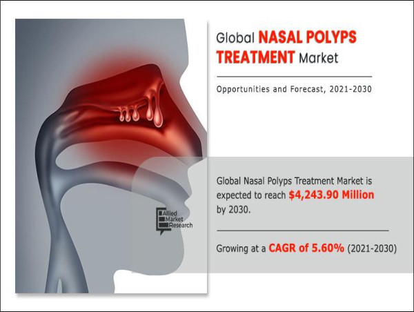  Nasal Polyps Treatment Market Set to Surge to $4.24 Billion by 2030 at a 5.6% CAGR 