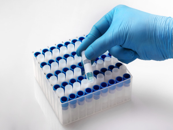 GMP Cell Banking Services Market Set to Witness Significant Growth by 2025-2032: Eurofins Scientific, Lonza Group Ltd. 