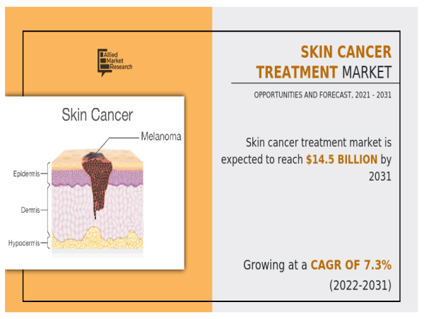 The Global Skin Cancer Treatment Market: Trends, Growth, and Future Outlook
