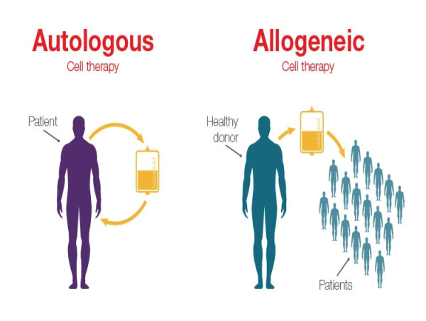  Autologous Cell Therapy Market to Reach USD 22.30 Billion by 2032, Growing at a CAGR of 22.1% 