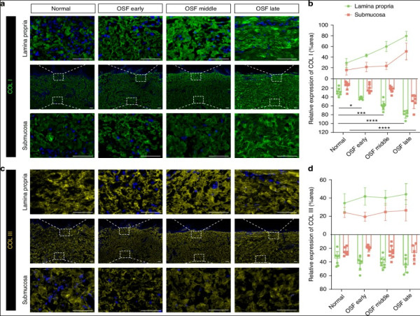 Revealing the key player in oral submucous fibrosis: could COMP be the solution?