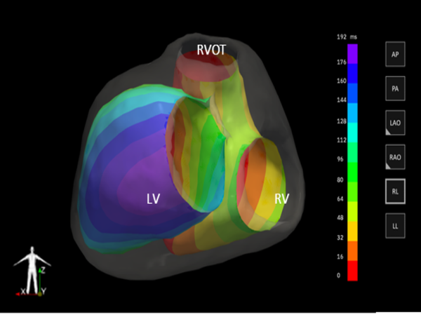 XSpline SPA Achieves MDR Certification for N.I.C.E., its AI-Powered Cardiac Mapping Software