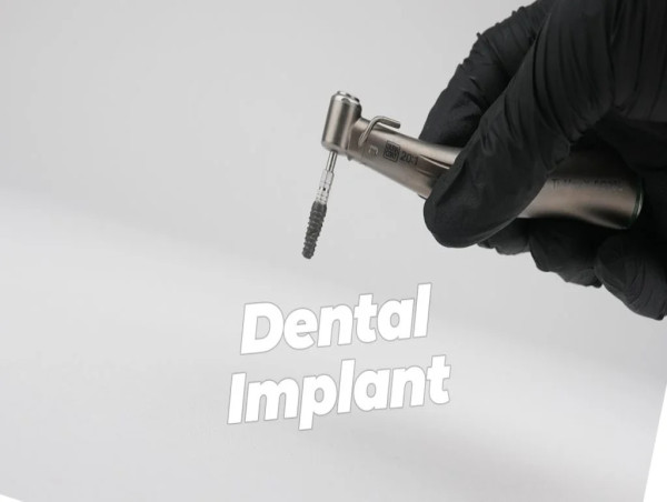 British Patients Flock to Türkiye for Affordable Dental Treatments