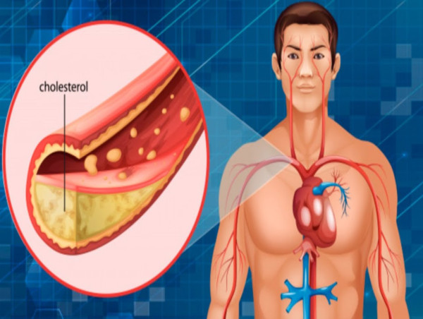  Cholesterol API Market Set for Steady Growth Through 2035 