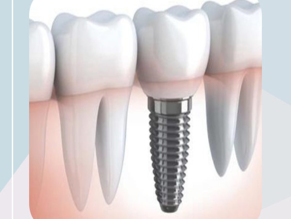  Bio-Implants Market Expected to Gain USD 137.6 Billion in Value Between 2025 and 2035 