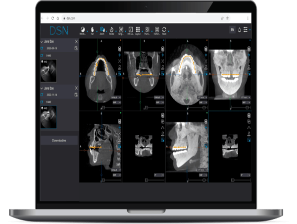  DSN Software Launches the First Cloud-Based Imaging Platform for Dental Specialists 