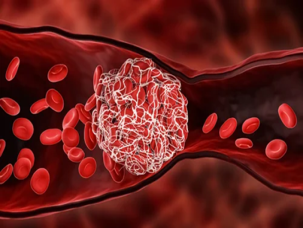  Hemophilia A Market Epidemiology Report 2025-2035: Drug Pipeline, Treatment, Trends, Rising Incidence & prevalence 