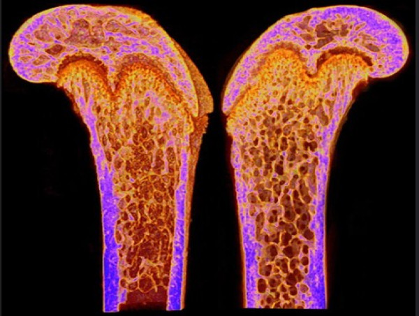  Aging Disrupts Osteocyte Networks and Bone Structure, with Greater Impact in Males 