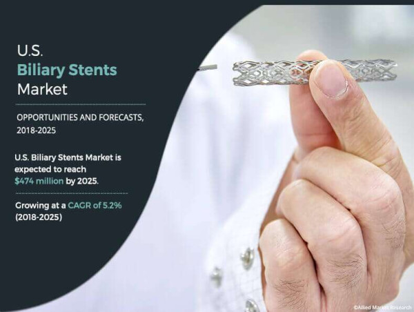  U.S. Biliary Stents Market Size Sets New Record, Projected at USD 474 Million by 2025 | CAGR of 5.2% 