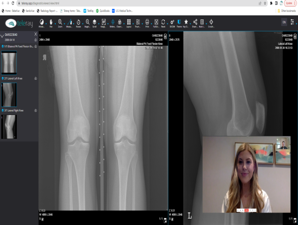 DataFirst Announces Strategic Partnership with TeleRay to Transform Virtual Care and Radiology Imaging Through AI