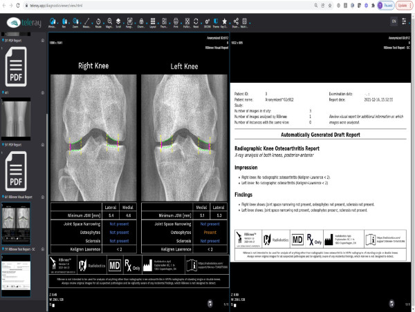  TeleRay Awarded 'Top Robust Virtual Care Platform' by Healthcare Tech Outlook Magazine for Value, HiTech and Security 