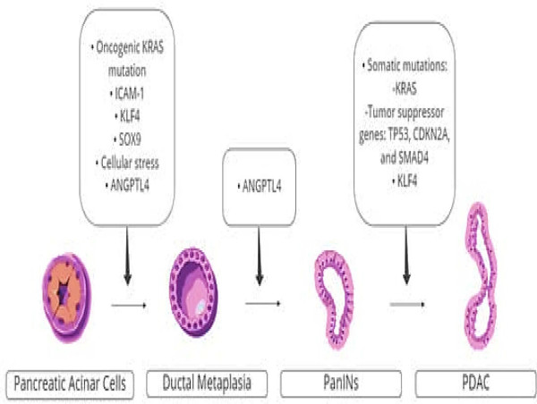  AI models might spot pancreatic cancer at an early stage and predict the deadly disease’s prognosis 