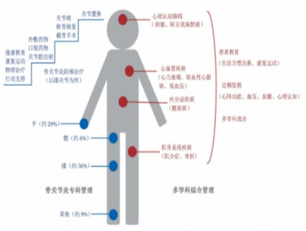  Beyond joint pain: the hidden harms of osteoarthritis 