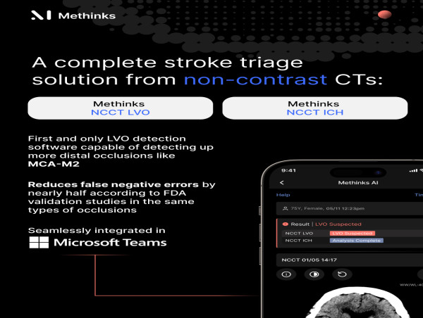  Methinks AI receives FDA 510(k) clearance to expand the frontiers of Non-Contrast CT for stroke triage 