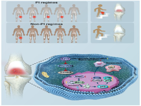  The Hidden Drawbacks of HIV: Treatment Regimens may Exacerbate Risk of Knee Arthritis 