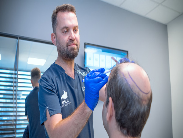 Americans Are Crossing the Atlantic for Hair Transplants