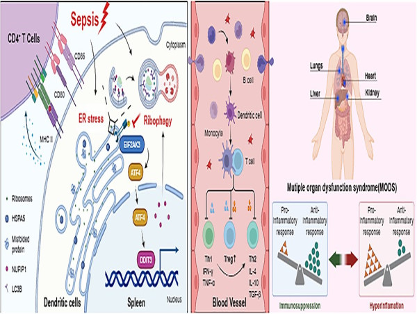 Targeting nufip1: a new strategy for sepsis treatment through ribophagy 
