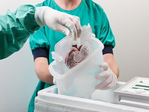 Organ Preservation Market Driven by Rising Organ Transplantation Rates and Advancements in Preservation Solutions