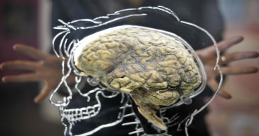 Experts identify link between head injuries and brain tumours
