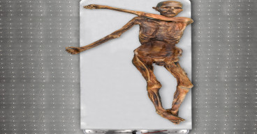 Iceman Otzi had dark skin and male pattern baldness, analysis reveals