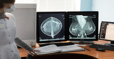 Hologic stock price bounced back: What nest for HOLX?