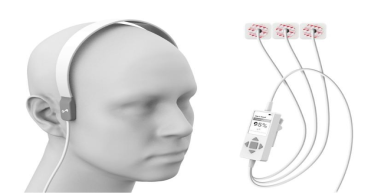 MindRhythm Completes Enrollment in its Multicenter Prehospital Trial for Identifying Large Vessel Occlusion Stroke