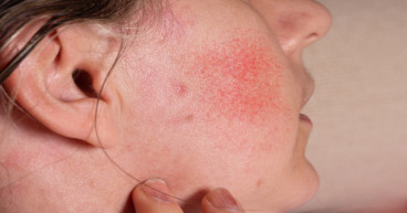 Examining CBD's Integration Into The Skincare Narrative With Solalusso Line