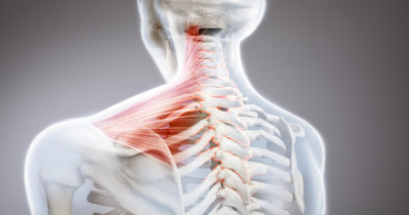Cervical Dystonia Market is Projected to Grow at a CAGR of 5.84% from 2023-2033
