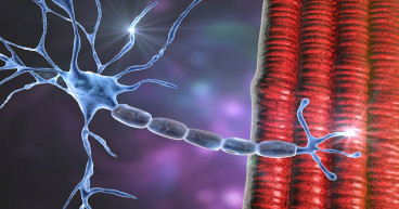 Amyotrophic Lateral Sclerosis (ALS) Market to Reach US$ 709.7 Million by 2033, at CAGR of 3.68% from 2023 to 2033