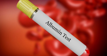 Albumin Market Size, Industry Analysis, Growth Rate, Trends, Report 2024-2032