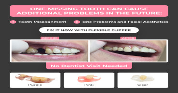 Smile Boutique NY Offers Affordable Dental Solutions from Home