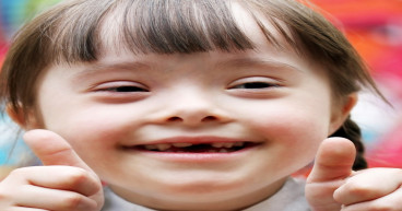 Down Syndrome Market Size Expected to Reach US$ 3.8 Billion by 2034 | IMARC Group
