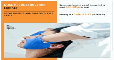 The Emerging Nose Reconstruction Market: Trends, Technologies, and Future Prospects 2020-2030