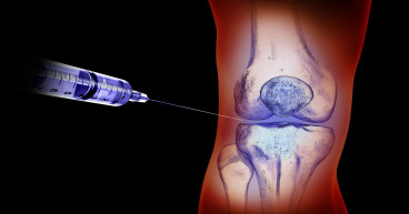 United States of America Viscosupplementation Market: US$ 1.54 Billion to US$ 2.87 Billion Growth Forecast (2024-2031)