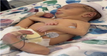 The Regents' and a Partner Physician Allegedly Caused a Wrongful Life / Birth and Committed a Medical Battery