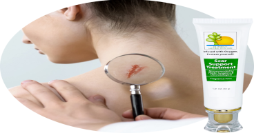 Proper care of a scar is critical to its healing process - Scar Support Treatment