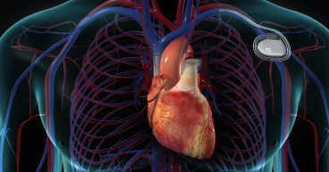 Cardiac Pacemaker Market Share Growth Status, Emerging Technology, and Forecast till 2031| Medtronic, Abbott, Pacetronix 