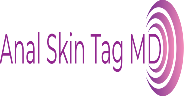 Anal Skin Tag MD Unveils Revolutionary Non-Surgical Procedure for Anal Skin Tag Removal