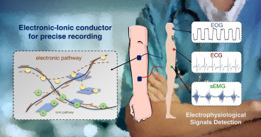 Soft Patch Electrodes Introduced for Advanced Human Body Signal Monitoring