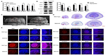 New genetic insights into hypospadias: MAFB and CEBPA’s role in urothelial growth
