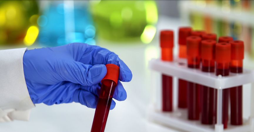 Japanese Patent Office Accepted SUDA’s Anagrelide Cancer Patent Application; Stock Surged Over 10%