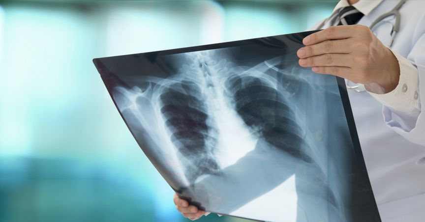 The emergence of Pro Medicus: How did the company grow sans external funding