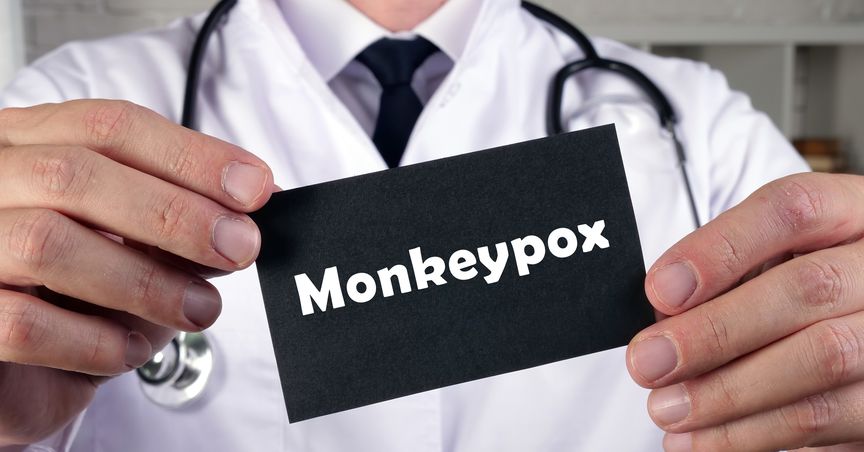  Can monkeypox wreck stock markets? Which TSX stocks to bag for safety? 