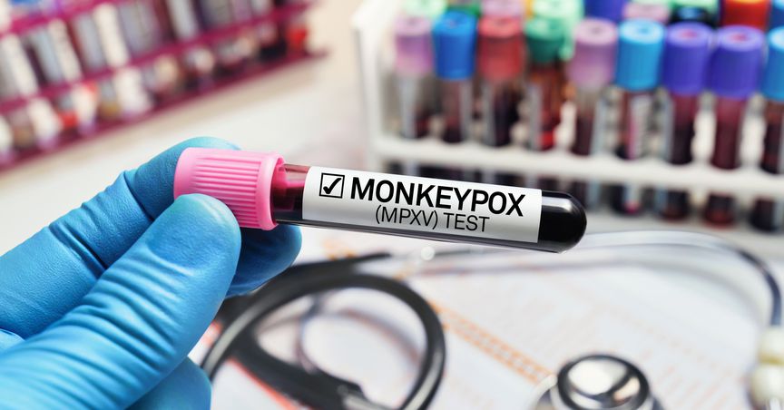 Monkeypox expands its presence in Canada: Can it affect stock markets?
