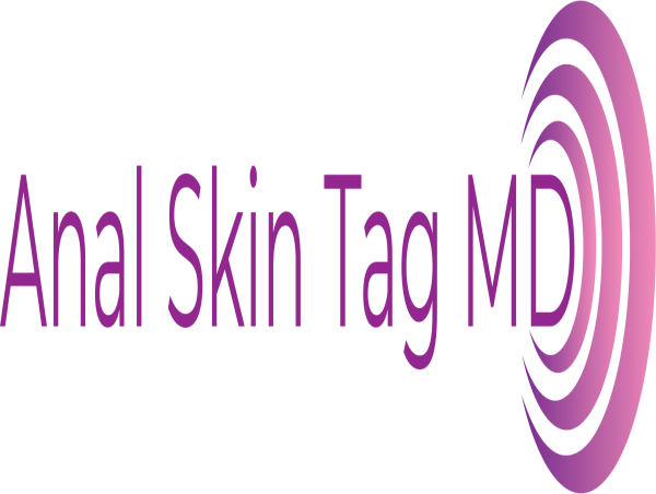 Anal Skin Tag Removal A Revolutionary Non Surgical Procedure For Lasting Results Kalkine Media 