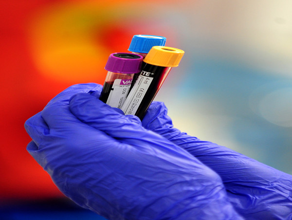 Adults With Rare Blood Disorder To Be Offered Stem Cell Transplants ...