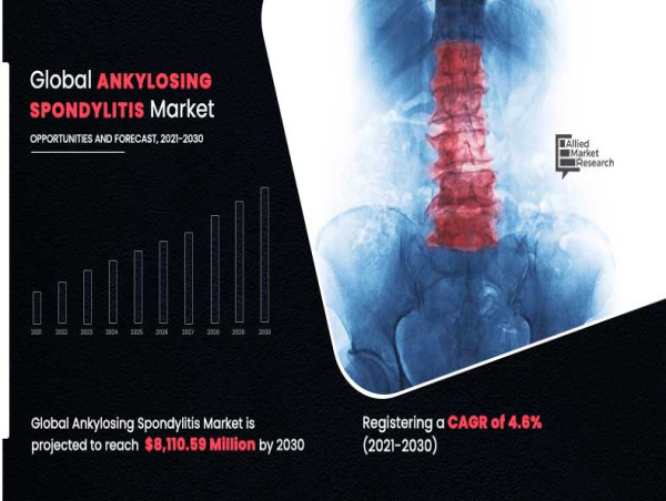  $8.11+ Bn Ankylosing Spondylitis Market by 2030: Growth at 4.6% CAGR 